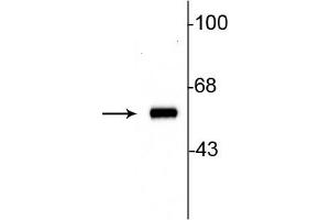 Western blot of 10ug of rat striatal lysate showing specific immunolabeling of the ~60 kDa tyrosine hydroxylase protein. (Tyrosine Hydroxylase 抗体)