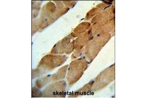 Formalin-fixed and paraffin-embedded human skeletal muscle reacted with TNFSF11 Antibody (N-term), which was peroxidase-conjugated to the secondary antibody, followed by DAB staining. (RANKL 抗体  (N-Term))