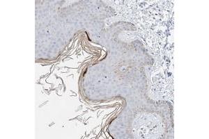 Immunohistochemical staining of human skin with KPRP polyclonal antibody  shows positivity in upper layer of epidermis at 1:200-1:500 dilution. (KPRP 抗体)