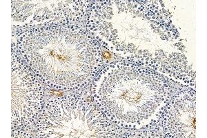 ABIN6264694 and ABIN6278626 at 1/100 staining rat testis tissue by IHC-P. (RELT 抗体  (C-Term))