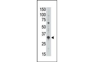 The anti-GEA3 (C-term) Antibody (ABIN390107 and ABIN2840619) is used in Western blot to detect GEA3 in Jurkat lysate. (MAGEA3 抗体  (C-Term))