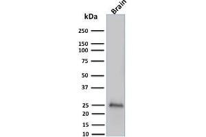 Western Blot Analysis of human brain tissue lysate using Pgp9. (UCHL1 抗体)