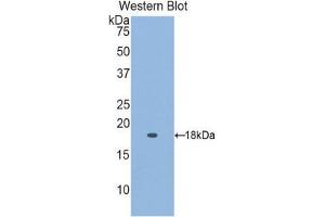 Western Blotting (WB) image for anti-Retinol Binding Protein 5, Cellular (RBP5) (AA 2-135) antibody (ABIN1860417) (Retinol Binding Protein 5 抗体  (AA 2-135))