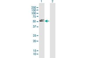 Western Blot analysis of DBT expression in transfected 293T cell line by DBT MaxPab polyclonal antibody. (DBT 抗体  (AA 1-482))