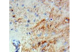 Used in DAB staining on fromalin fixed paraffin-embedded Brain tissue (SERPINB2 抗体  (AA 170-393))