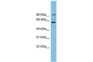 WB Suggested Anti-ANKRD5 Antibody Titration: 0. (ANKRD5 抗体  (N-Term))