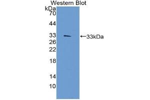 Western blot analysis of the recombinant protein. (TEP1 抗体  (AA 2368-2627))