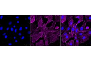 Immunocytochemical staining of H9c2 cells with PDLIM1 antibody (ABIN7799748), 1:1,000).
