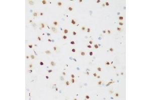 Immunohistochemistry of paraffin-embedded mouse brain using CSRNP1 antibody (ABIN5974288) at dilution of 1/200 (40x lens). (AXUD1 抗体)