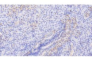 Detection of ALB in Human Kidney Tissue using Polyclonal Antibody to Albumin (ALB) (Albumin 抗体)