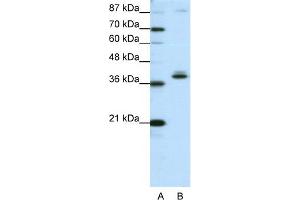 WB Suggested Anti-ZNF25 Antibody Titration:  1. (ZNF25 抗体  (C-Term))