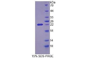 SDS-PAGE analysis of Mouse CDKN2D Protein. (CDKN2D 蛋白)