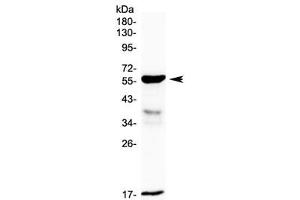 Western blot testing of rat small intestine lysate with GALNS antibody at 0. (GALNS 抗体)