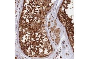 Immunohistochemical staining of human testis with CABP5 polyclonal antibody  shows strong cytoplasmic positivity in cells in seminiferus ducts. (CABP5 抗体)