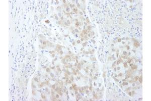Immunohistochemistry (IHC) image for anti-Eukaryotic Translation Initiation Factor 4E Binding Protein 1 (EIF4EBP1) (C-Term) antibody (ABIN7448395) (eIF4EBP1 抗体  (C-Term))