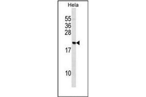Western blot analysis of PAIP2 Antibody (N-term) in Hela cell line lysates (35ug/lane). (PAIP2 抗体  (N-Term))
