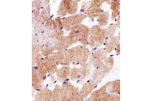 Immunohistochemistry (Paraffin-embedded Sections) (IHC (p)) image for anti-Succinate Dehydrogenase Complex, Subunit A, Flavoprotein (Fp) (SDHA) (AA 577-605), (C-Term) antibody (ABIN1881780)