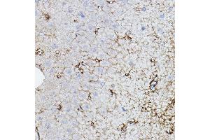 Immunohistochemistry of paraffin-embedded rat brain using CHAT Rabbit pAb (ABIN3016134, ABIN3016135, ABIN3016136 and ABIN6219569) at dilution of 1:50 (40x lens). (Choline Acetyltransferase 抗体  (AA 331-630))