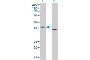 Western Blot analysis of F3 expression in transfected 293T cell line by F3 monoclonal antibody (M01), clone 4G4.