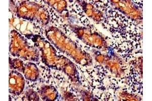 Immunohistochemistry of paraffin-embedded human small intestine tissue using ABIN7170381 at dilution of 1:100 (SNX27 抗体  (AA 458-497))