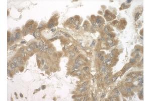 anti-Staphylococcal Nuclease Domain Containing Protein 1 (SND1) (AA 100-150) antibody