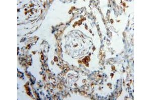 Used in DAB staining on fromalin fixed paraffin-embedded lung tissue (Vimentin 抗体  (AA 2-466))
