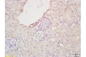 Formalin-fixed and paraffin embedded mouse liver labeled with Rabbit Anti FABP3/Cardiac FABP Polyclonal Antibody, Unconjugated (ABIN1387630) at 1:200 followed by conjugation to the secondary antibody and DAB staining