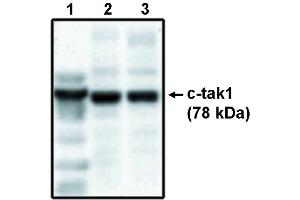 Western blot analysis using c-tak1 antibody . (TR4 抗体)
