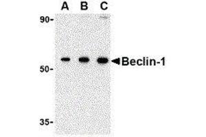 Western Blotting (WB) image for anti-Beclin 1, Autophagy Related (BECN1) (N-Term) antibody (ABIN2477609) (Beclin 1 抗体  (N-Term))