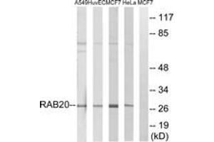 Western blot analysis of extracts from HeLa/MCF-7/HuvEc/A549 cells, using RAB20 Antibody. (RAB20 抗体  (AA 115-164))
