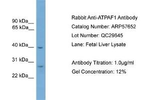 WB Suggested Anti-ATPAF1  Antibody Titration: 0. (ATPAF1 抗体  (Middle Region))
