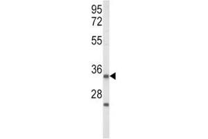 Western blot analysis of IGFBP2 antibody and Jurkat lysate (IGFBP2 抗体  (AA 277-305))