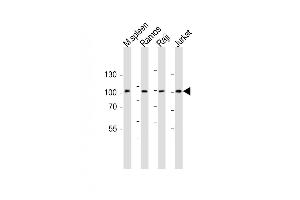 All lanes : Anti-BCL6 Antibody (Center) at 1:1000 dilution Lane 1: mouse spleen lysate Lane 2: Ramos whole cell lysate Lane 3: Raji whole cell lysate Lane 4: Jurkat whole cell lysate Lysates/proteins at 20 μg per lane. (BCL6 抗体  (AA 364-395))