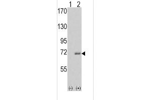 Western blot analysis of IRAK1 (arrow) using rabbit polyclonal IRAK Antibody (C-term) . (IRAK1 抗体  (C-Term))