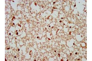 IHC image of ABIN7148507 diluted at 1:300 and staining in paraffin-embedded human brain tissue performed on a Leica BondTM system. (COPS8 抗体  (AA 150-198))