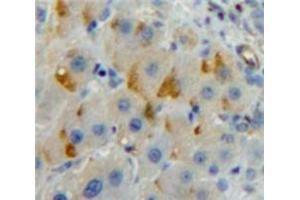 Used in DAB staining on fromalin fixed paraffin-embedded Liver tissue (LILRB3 抗体  (AA 410-631))