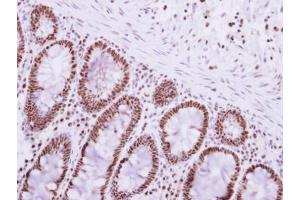Immunohistochemistry (IHC) image for anti-Poly A Binding Protein Nuclear 1 (PABPN1) antibody (ABIN2855064)