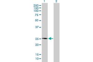 PLA2G4D Antikörper  (AA 1-216)