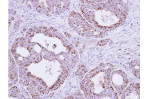 IHC-P Image Immunohistochemical analysis of paraffin-embedded NCIN87 xenograft, using fumarate hydratase , antibody at 1:500 dilution. (FH 抗体)
