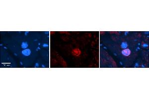 Rabbit Anti-NR5A1 Antibody  Catalog Number: ARP45620_P050 Formalin Fixed Paraffin Embedded Tissue: Human Adult heart  Observed Staining: Nuclear and some weak cytoplasmic Primary Antibody Concentration: 1:600 Secondary Antibody: Donkey anti-Rabbit-Cy2/3 Secondary Antibody Concentration: 1:200 Magnification: 20X Exposure Time: 0. (NR5A1 抗体  (Middle Region))