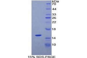 SDS-PAGE analysis of Human PLAA Protein. (PLAA 蛋白)