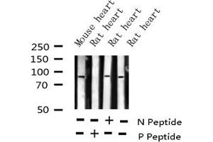 Western blot analysis of Phospho-ATRIP (Ser68) expression in various lysates (ATRIP 抗体  (pSer68))