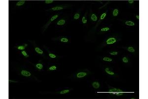Immunofluorescence of monoclonal antibody to FOS on HeLa cell. (c-FOS 抗体  (AA 1-100))