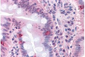 Human Small Intestine: Formalin-Fixed, Paraffin-Embedded (FFPE) (SEMA4B 抗体  (Internal Region))
