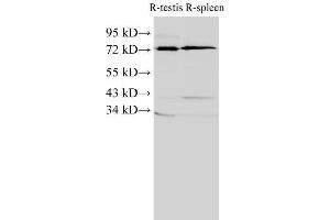 Western Blot analysis of Rat testis and Rat spleen using ANXA6 Polyclonal Antibody at dilution of 1:2000 (ANXA6 抗体)