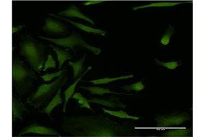Immunofluorescence (IF) image for anti-Casein Kinase 2, alpha Prime Polypeptide (CSNK2A2) (AA 1-100) antibody (ABIN514709)