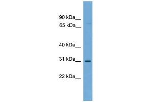 WB Suggested Anti-C1orf183 Antibody Titration: 0. (FAM212B 抗体  (Middle Region))