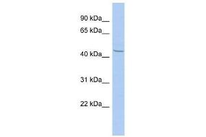 Western Blot showing ZBTB12 antibody used at a concentration of 1-2 ug/ml to detect its target protein. (ZBTB12 抗体  (N-Term))