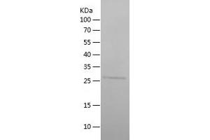 Western Blotting (WB) image for Protein Phosphatase 1, Regulatory (Inhibitor) Subunit 15A (PPP1R15A) (AA 464-674) protein (His tag) (ABIN7124666)
