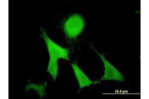 Immunofluorescence of monoclonal antibody to GAS2 on NIH/3T3 cell. (GAS2 抗体  (AA 1-110))